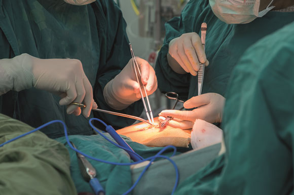Fistula