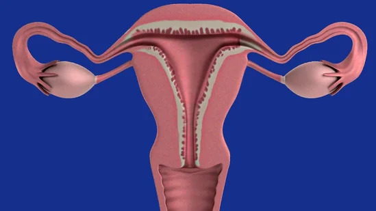 Ovarian cancer